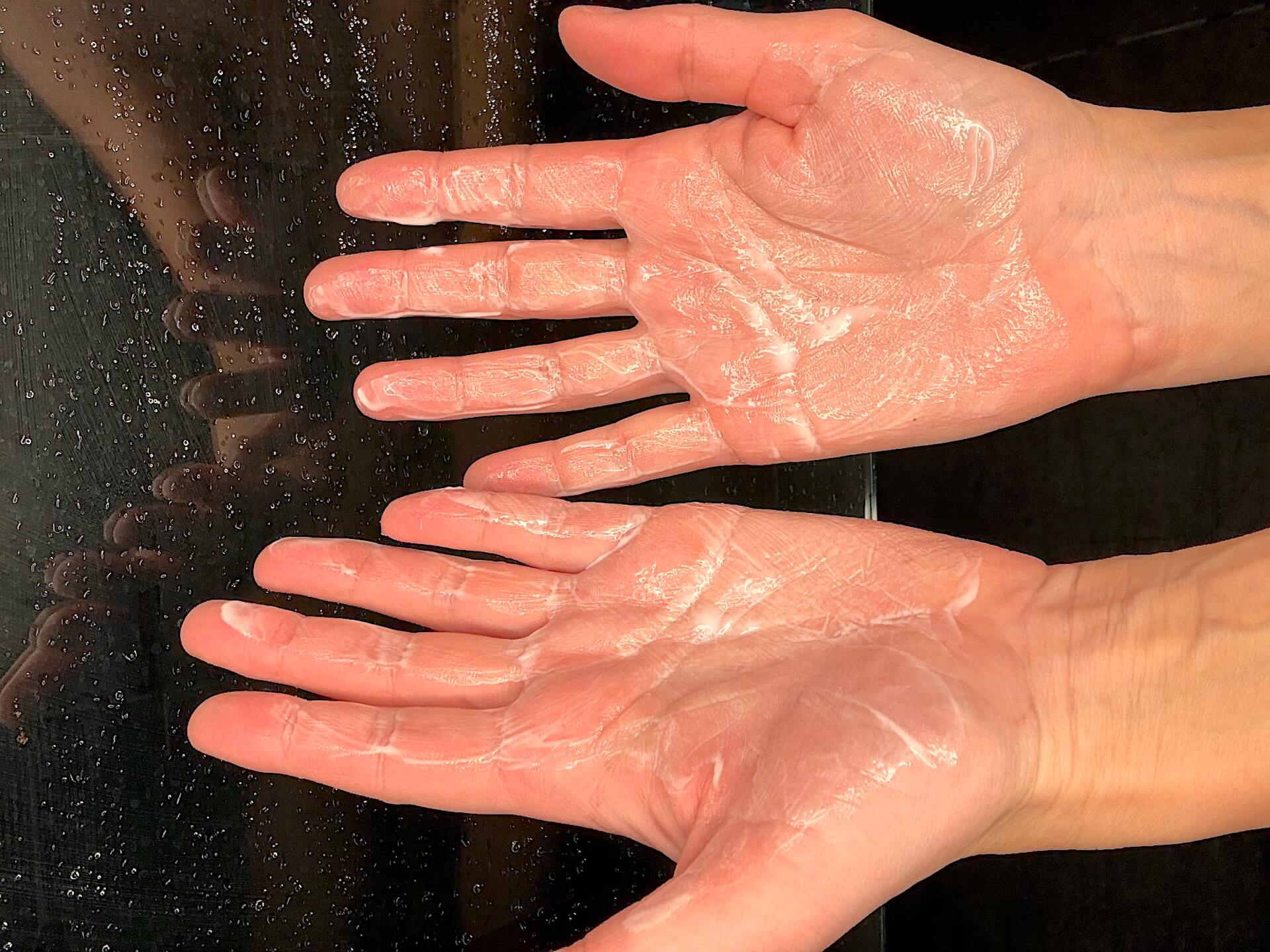 Australian Bodycare Salicylic Acid Keratosis Lotion på hænder