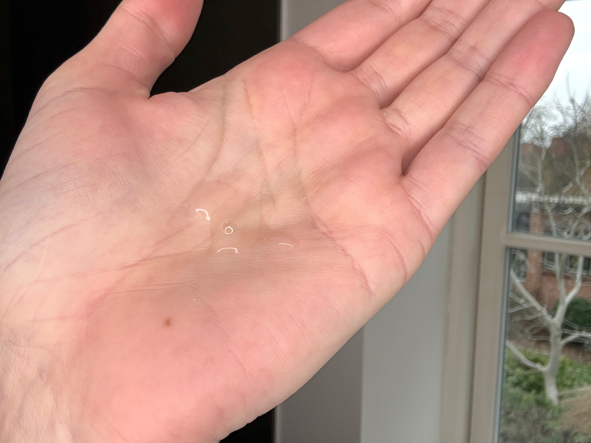 Australian Bodycare Salicylic Acid Serum 2% trykket ud i hånd