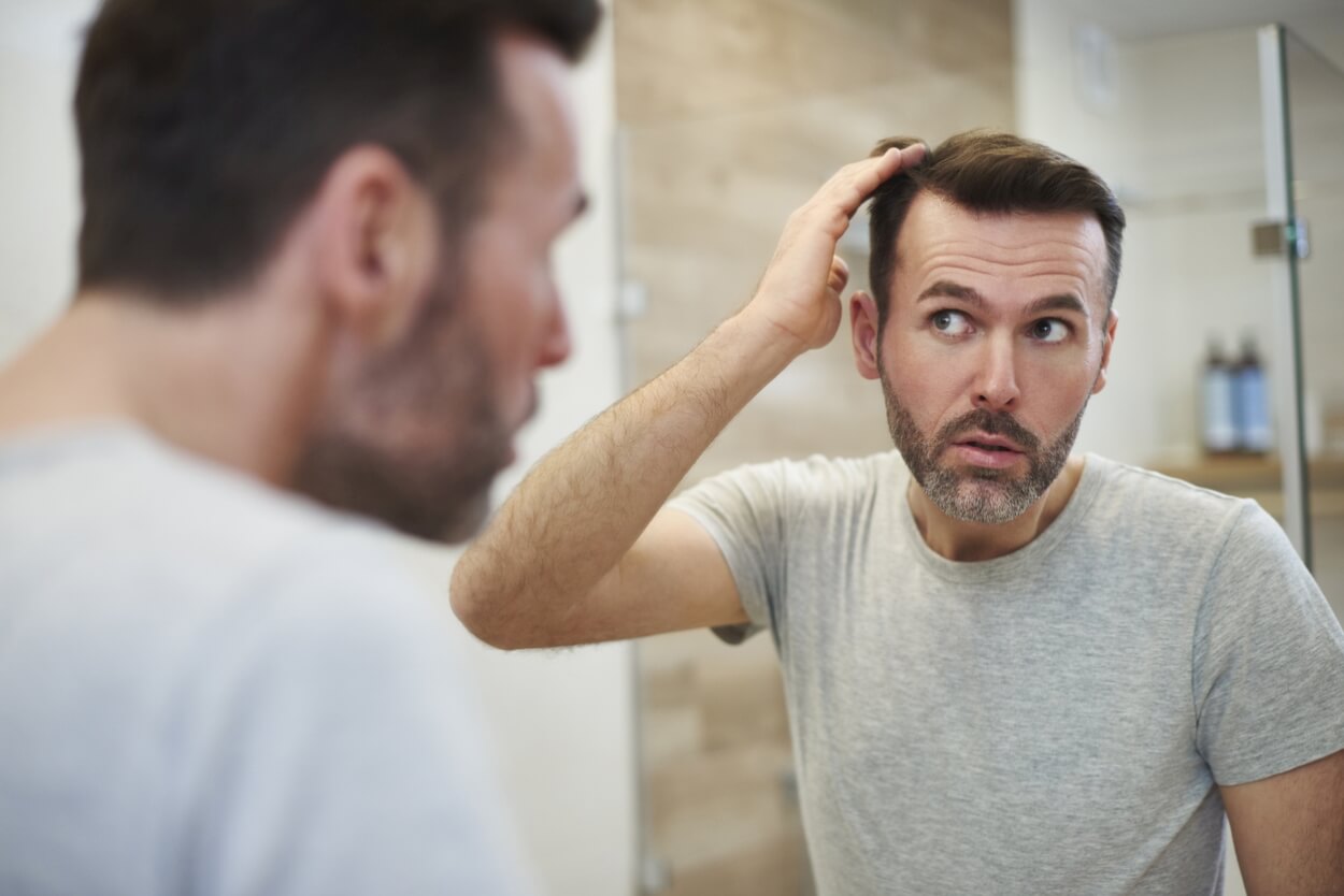 Høje tindinger? Forebyg et begyndende hårtab (+ 7 tips)