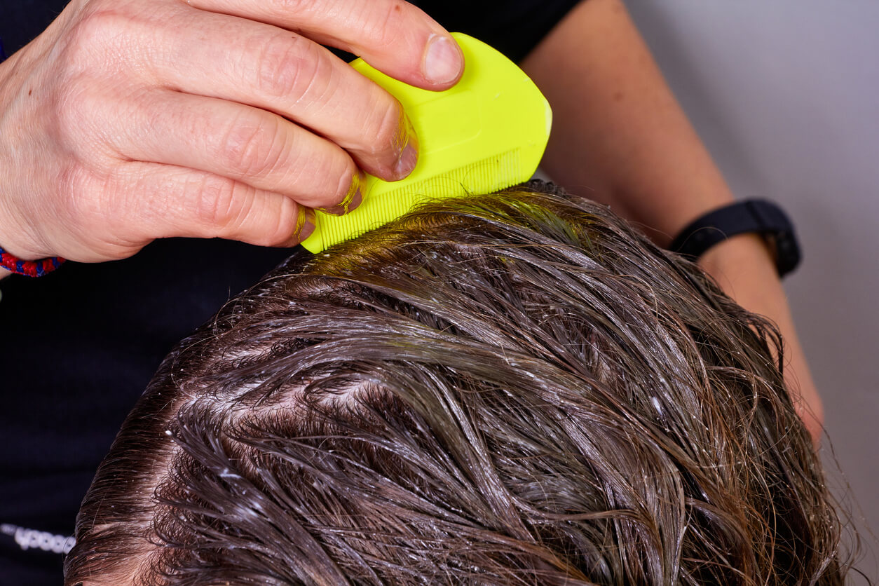 Hovedlus behandles med luseshampoo og lusekam