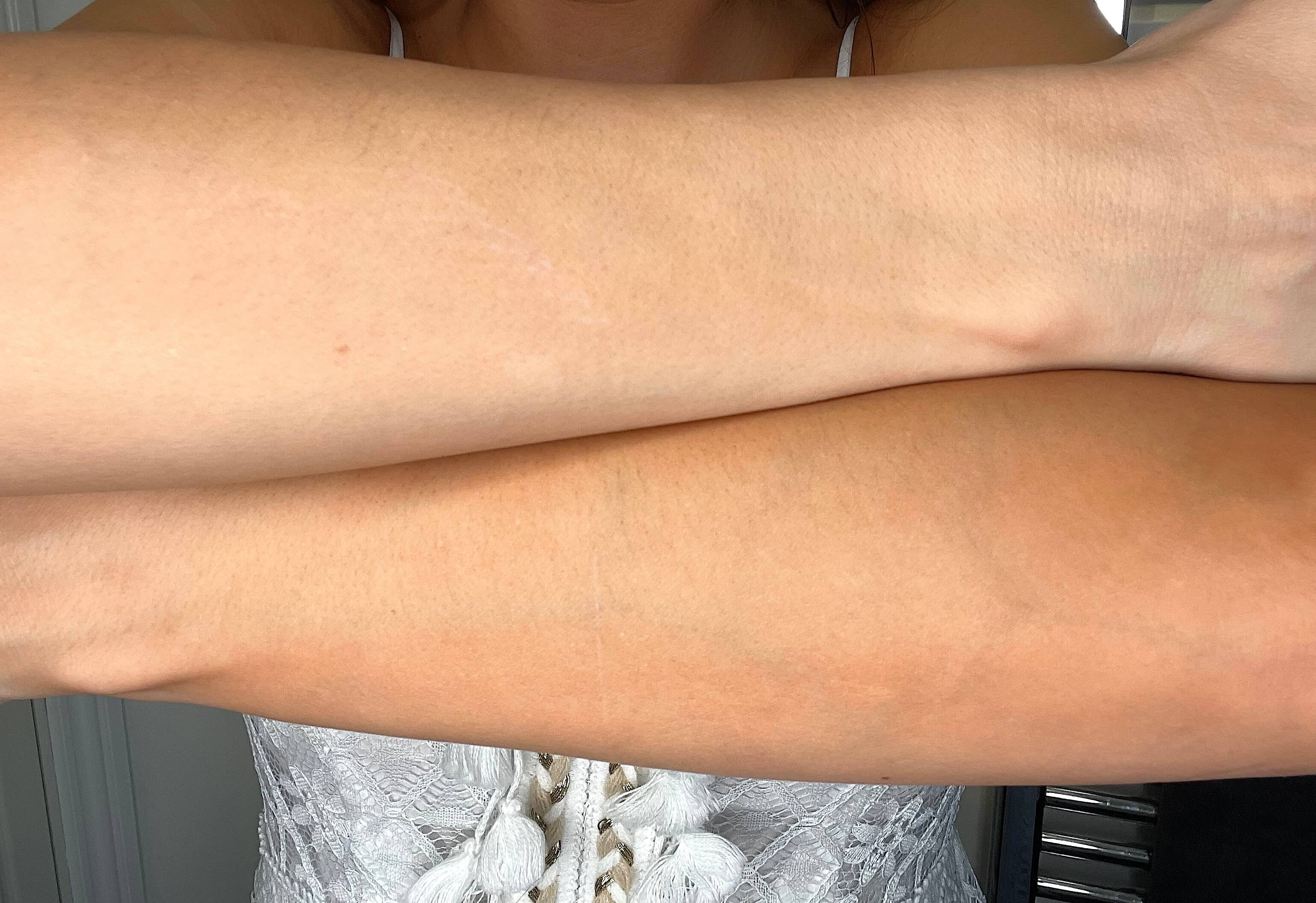 Resultat efter en gang på en arm med The Tan Co selvbruner lotion