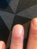 Indsendt af Jonas Larsen til artiklen Sådan behandler du bløde, tørre, flossede eller rillede negle